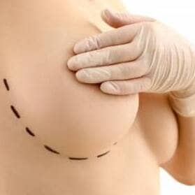 Meme küçültme operasyonu